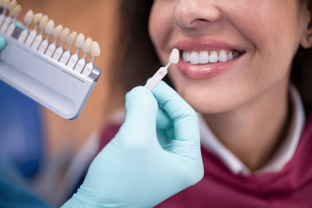porcelain veneers