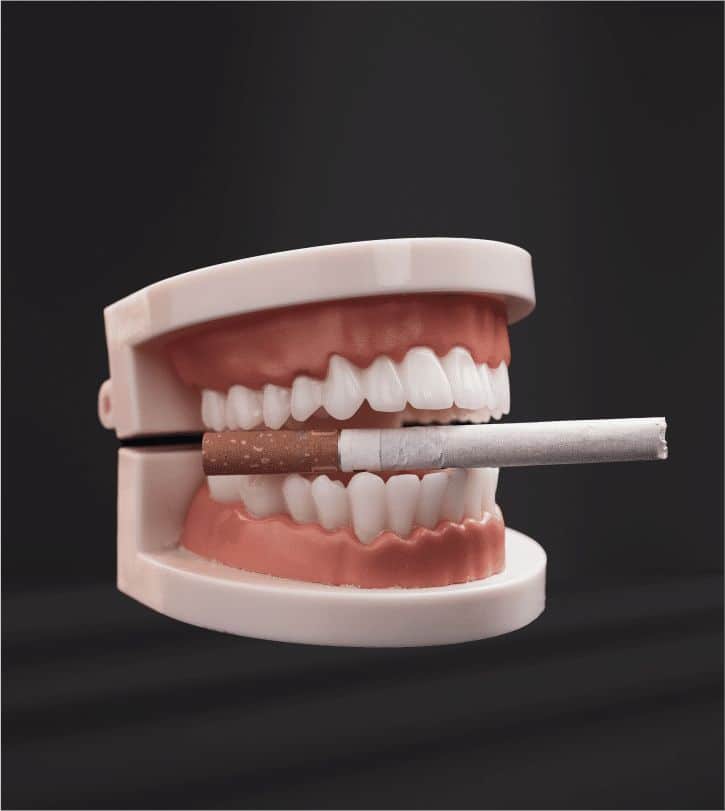 dental implant and smoking