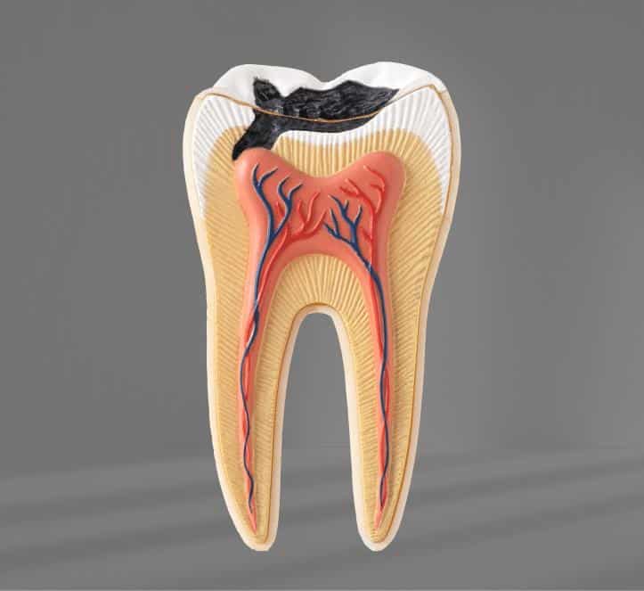 dental implants procedure