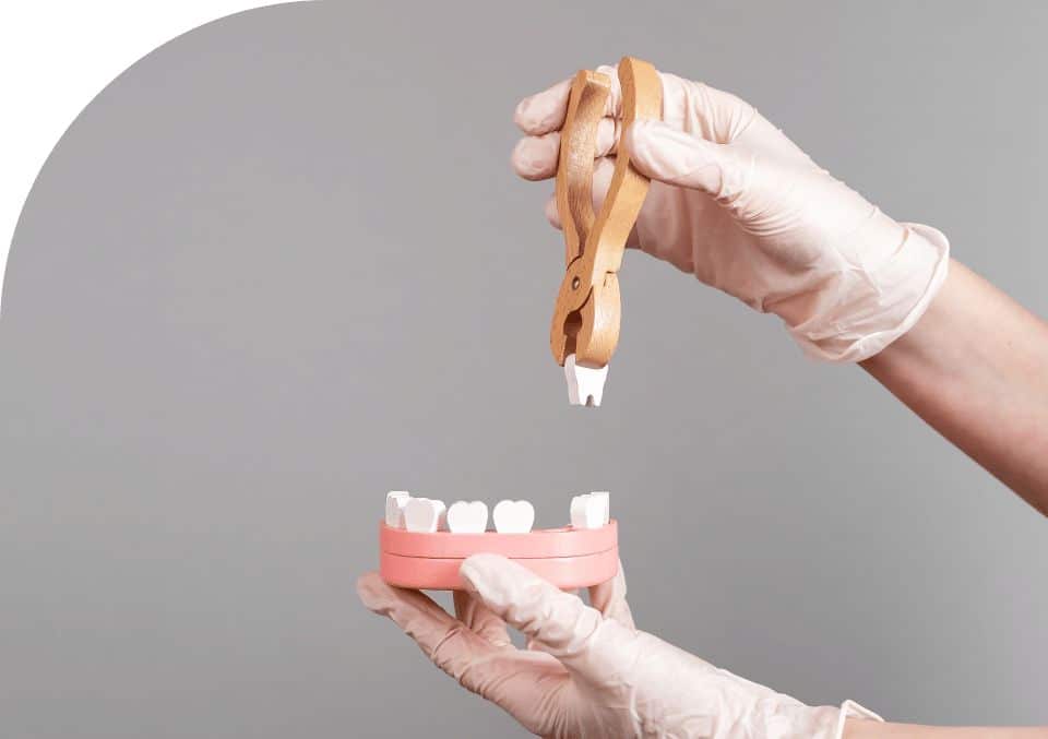 wisdom teeth removal