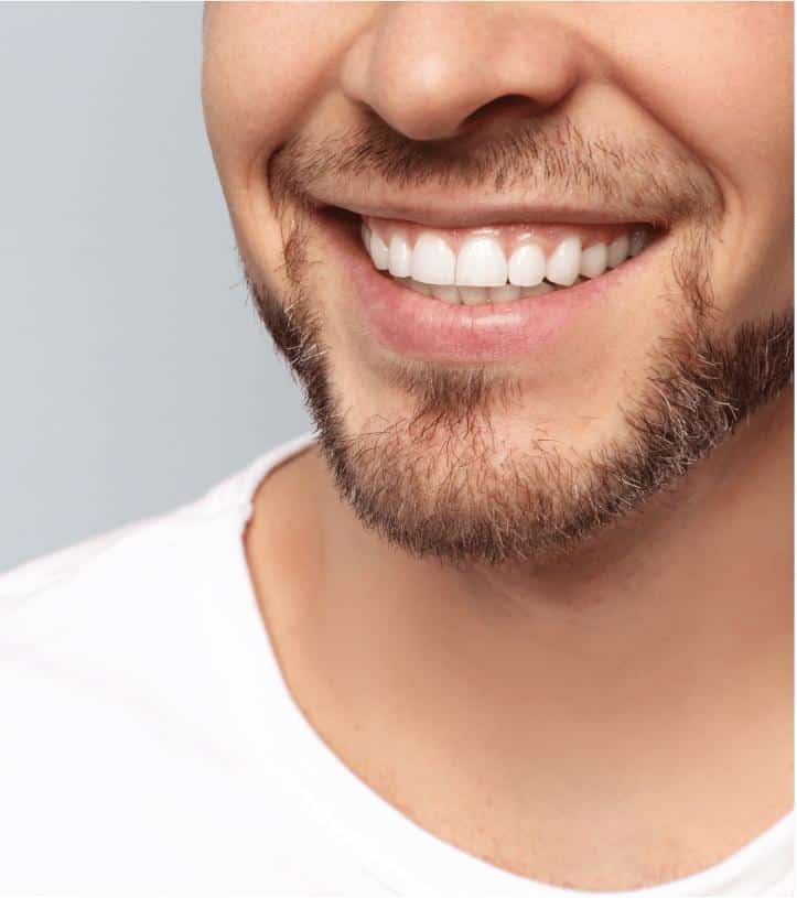 Full Mouth Dental Implant Treatment