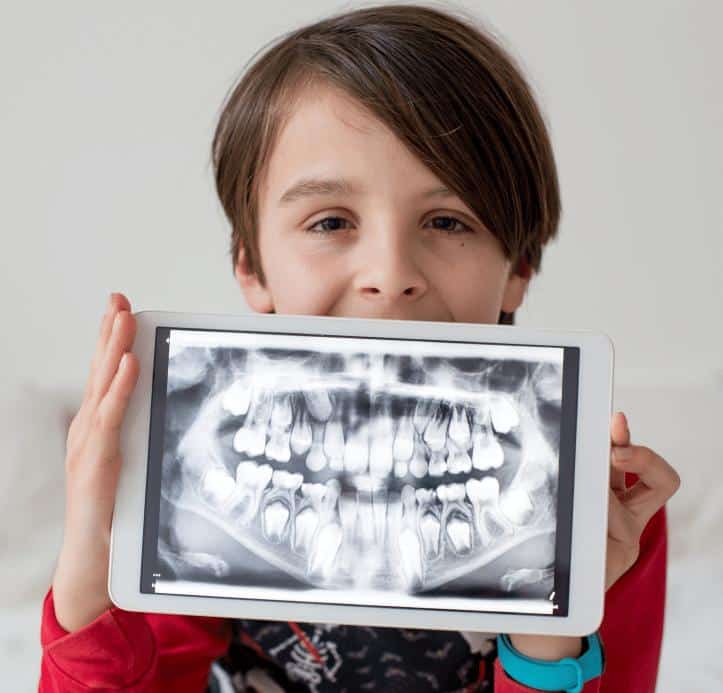 children holding his teeth x ray