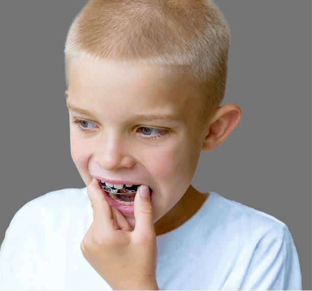 kids orthodontics