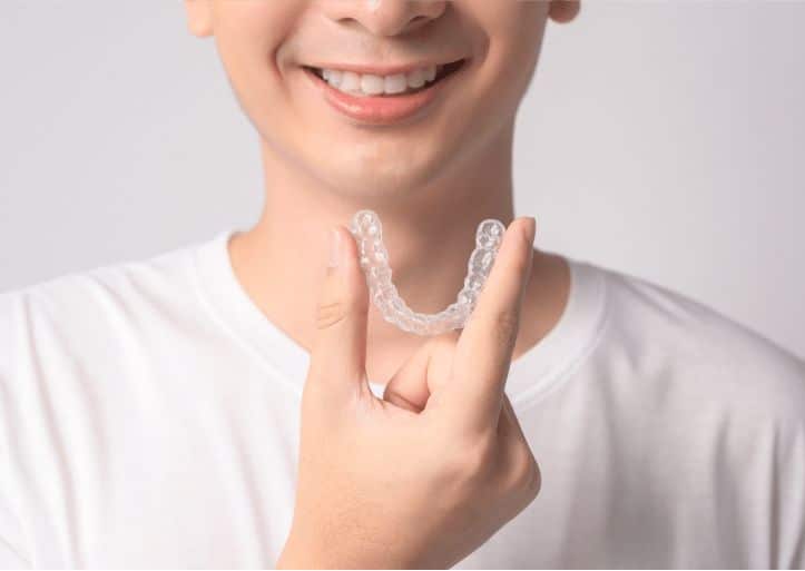 clear aligners