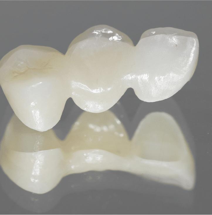 Bridges and Dentures