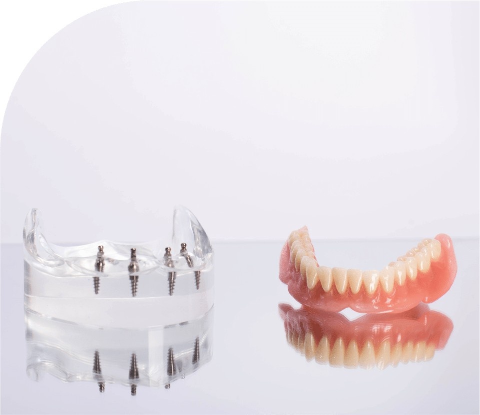 all on 4 dental implants