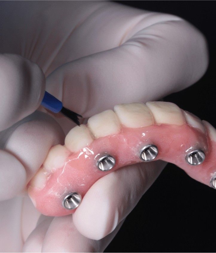 All on 4 dental implants